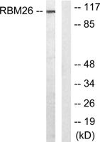 RBM26 Polyclonal Antibody