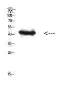 RCC1 Polyclonal Antibody