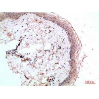 RCC1 Polyclonal Antibody