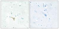 RECK Polyclonal Antibody