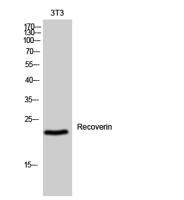 Recoverin Polyclonal Antibody