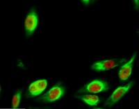 Tak1 Polyclonal Antibody