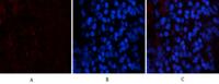 Tak1 Polyclonal Antibody