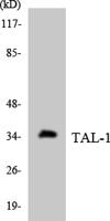 TAL1 Polyclonal Antibody