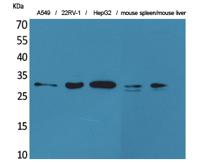 TALL-1 Polyclonal Antibody