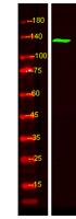 TAOK2 Polyclonal Antibody