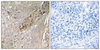 TAUT Polyclonal Antibody