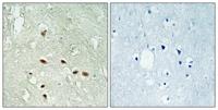 Rag A/B Polyclonal Antibody