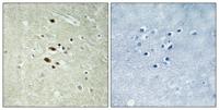 Rag A/B Polyclonal Antibody