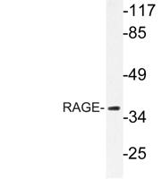 RAGE Polyclonal Antibody