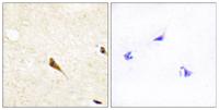 RAGE Polyclonal Antibody