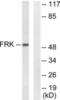 Rak Polyclonal Antibody