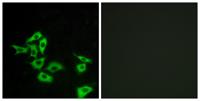 Frizzled-5/8 Polyclonal Antibody