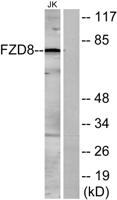 Frizzled-5/8 Polyclonal Antibody