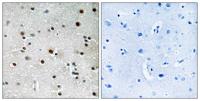 RFX3 Polyclonal Antibody