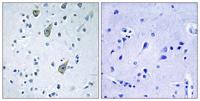 Frizzled-6 Polyclonal Antibody