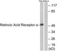 RARα Polyclonal Antibody