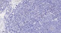 RASL10B Polyclonal Antibody