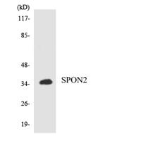 RASSF6 Polyclonal Antibody