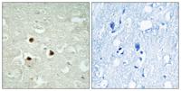 RAB3IP Polyclonal Antibody