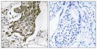 Rabaptin-5α Polyclonal Antibody