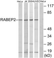 Rabaptin-5β Polyclonal Antibody