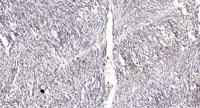 Rabenosyn-5 Polyclonal Antibody