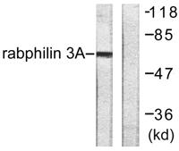 Rabphilin-3A Polyclonal Antibody