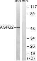 Rabr Polyclonal Antibody