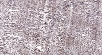 Rac GAP1 Polyclonal Antibody