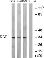 Rad GTPase Polyclonal Antibody