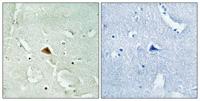 Rad23B Polyclonal Antibody