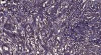 Rad50 Polyclonal Antibody