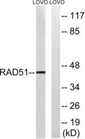 Rad51 Polyclonal Antibody