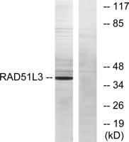 Rad51D Polyclonal Antibody