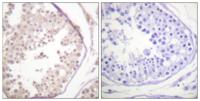 Rad52 Polyclonal Antibody