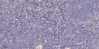 Rad54 Polyclonal Antibody