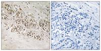 Rad54B Polyclonal Antibody