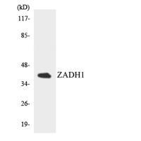 PTGR2 Polyclonal Antibody