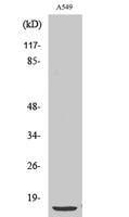 PTH Polyclonal Antibody