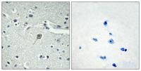 PTH/PTHrP-R Polyclonal Antibody