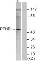 PTH/PTHrP-R Polyclonal Antibody