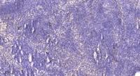 PTH-rP Polyclonal Antibody