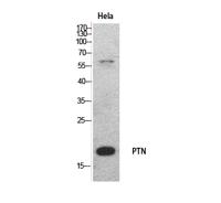 PTN Polyclonal Antibody