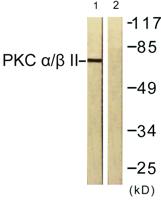 PKC α Polyclonal Antibody