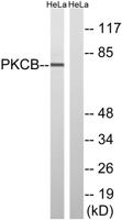 PKC β Polyclonal Antibody