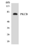 PKC β Polyclonal Antibody