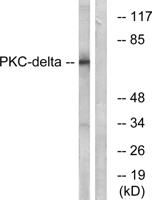 PKC δ Polyclonal Antibody