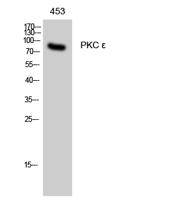 PKC ε Polyclonal Antibody