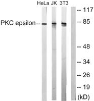 PKC ε Polyclonal Antibody